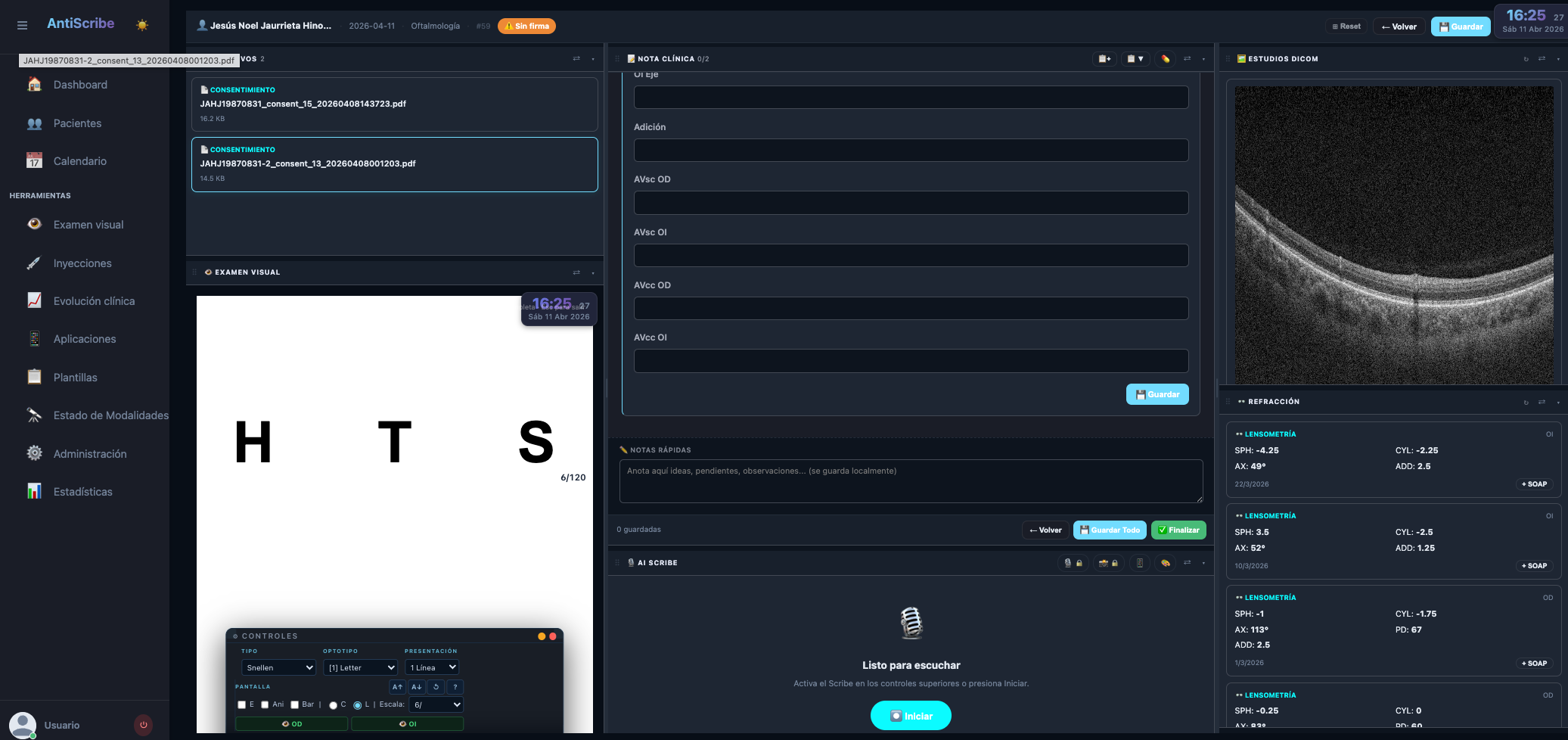 Clinical Glaucoma Output